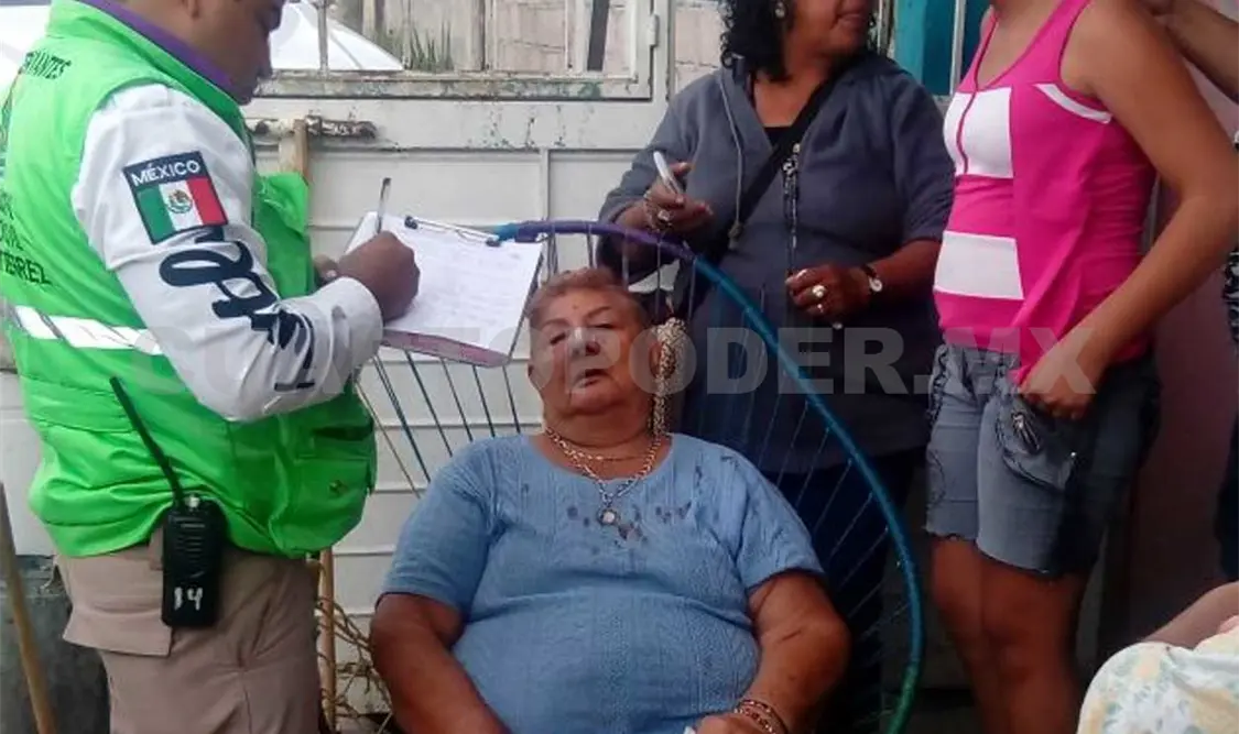 La víctima intentó pedir auxilio con los vecinos pero uno de los asaltantes le dio un golpe en el rostro y le provocó una lesión en la nariz. Rafael Cabrera / CP