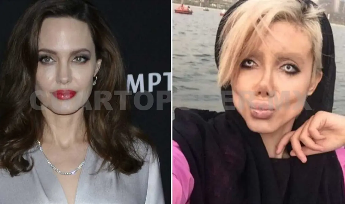 Quería parecerse a Angelina y se convirtió en zombie