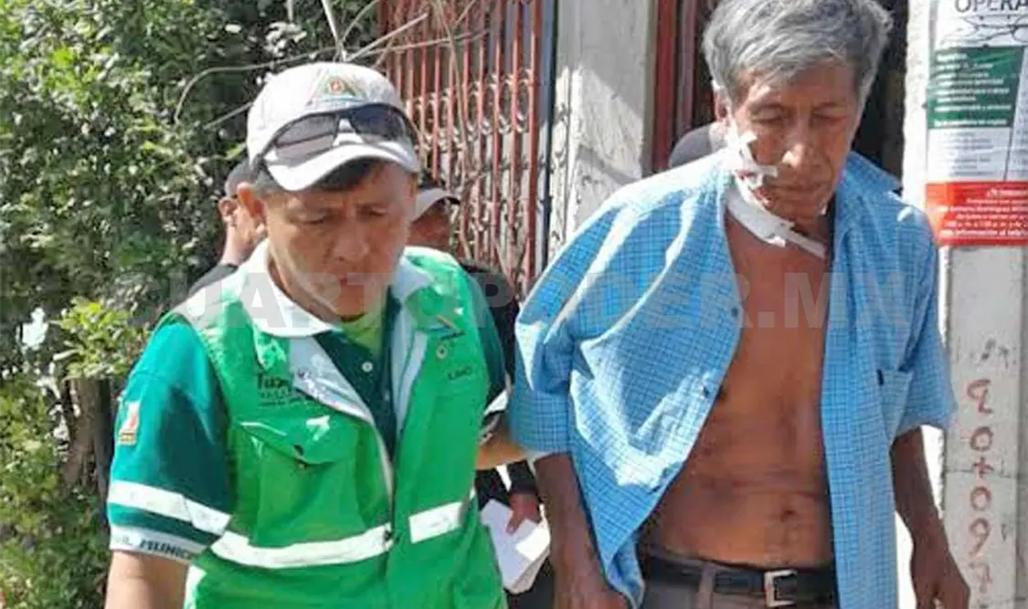 El adulto mayor se opuso a un asalto, fue herido en el cuello en la colonia Las Granjas. Avisaín Alegría / CP