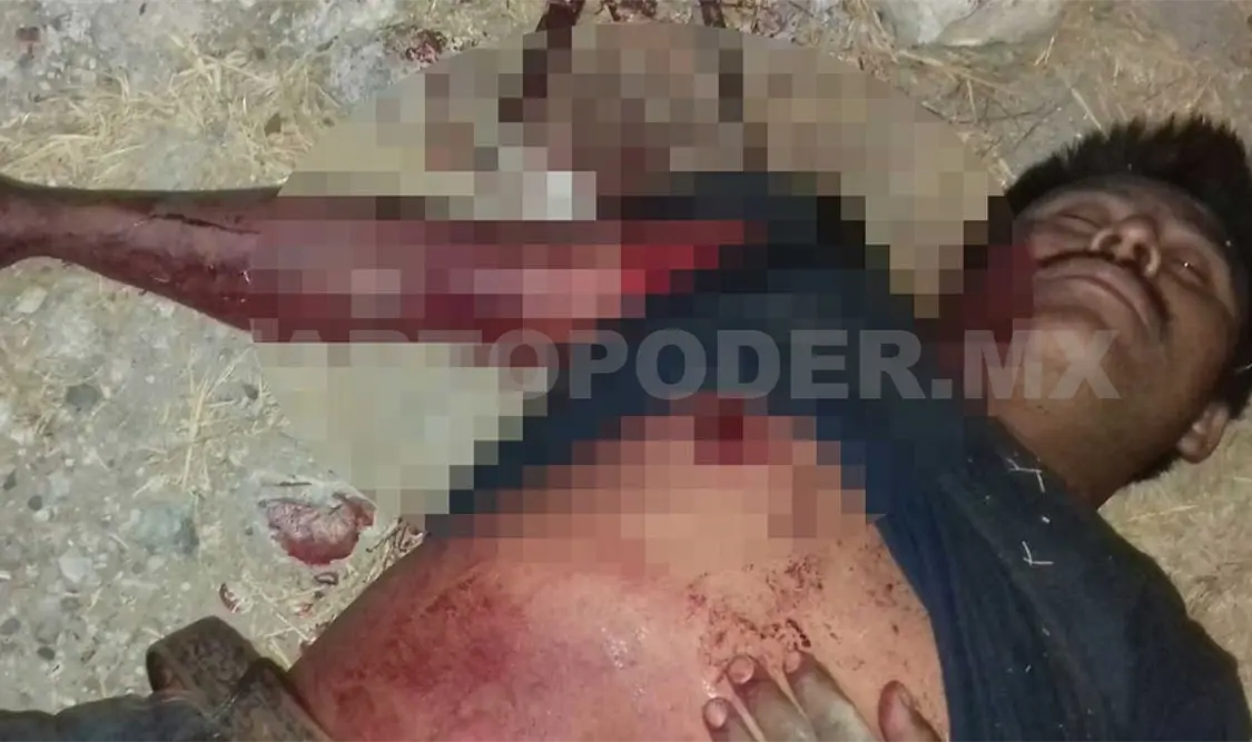 La policía se presentó al lugar para tomar conocimiento de los hechos; paramédicas trasladaron al herido a un hospital. Rafael Cabrera / CP