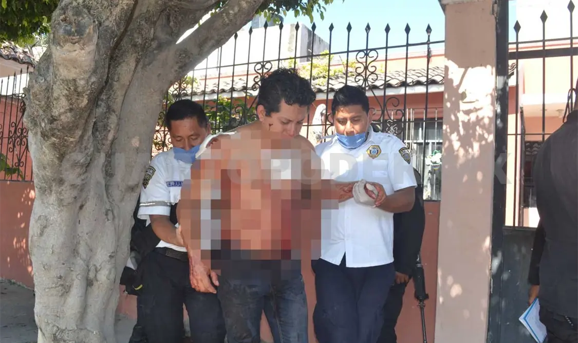 Su pareja sentimental lo atacó con un cúter