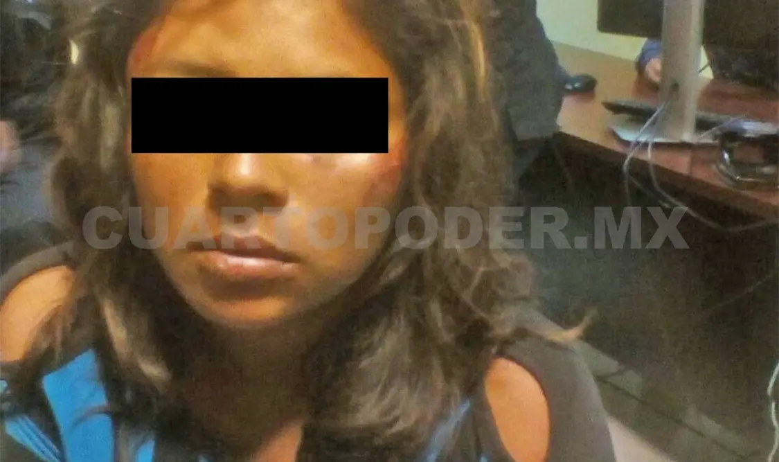 Policías lesionados al detener a mujer con moto robada