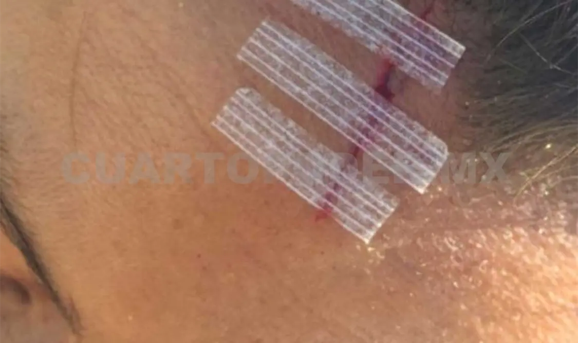 Sara Maldonado sufre accidente