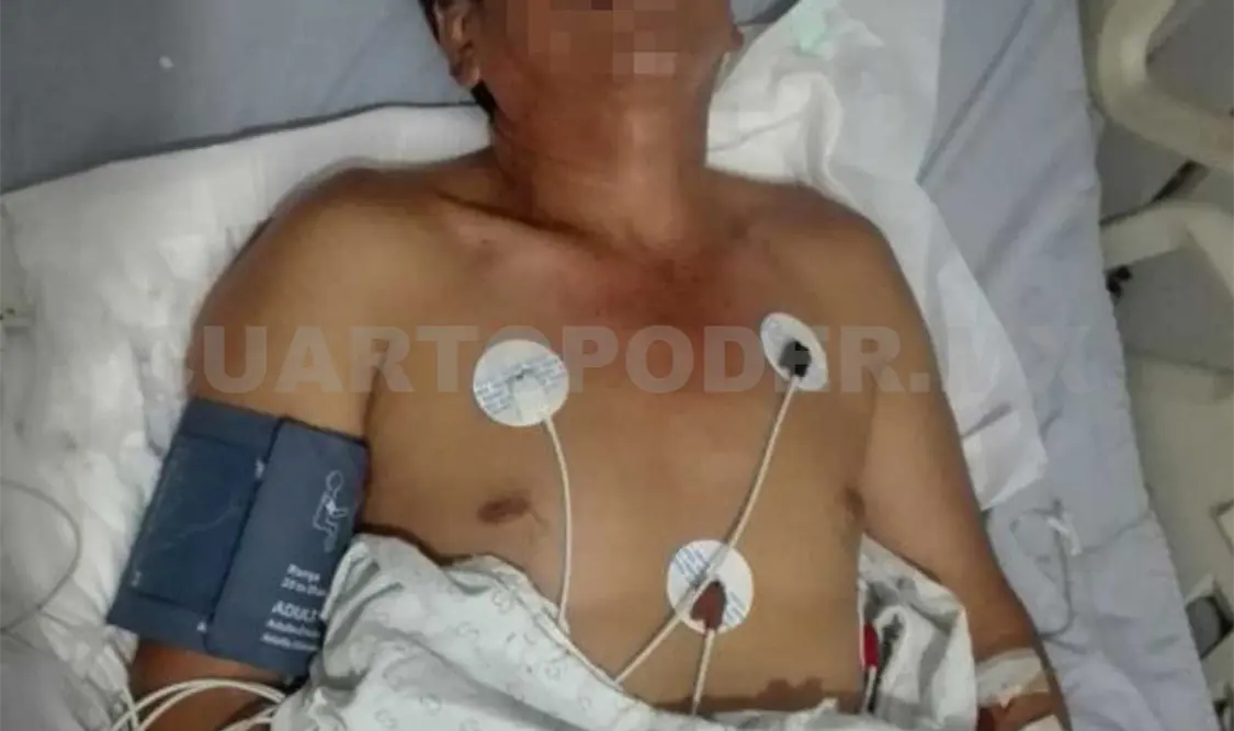 Los balean en un violento asalto