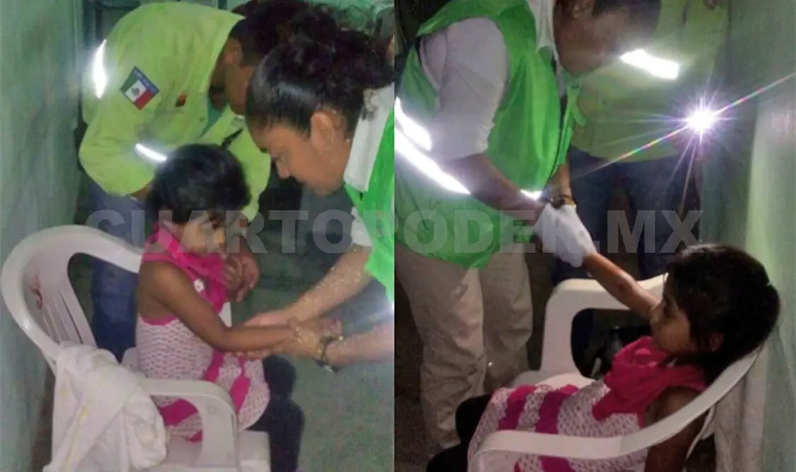 Pitbull ataca a niña y la manda al hospital