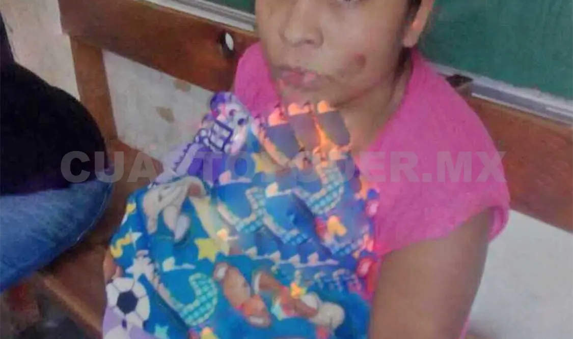 La joven resultó con quemaduras en el rostro, luego de ser alcanzada por un líquido que le lanzó la pareja para arrebatarle a su hija. CP