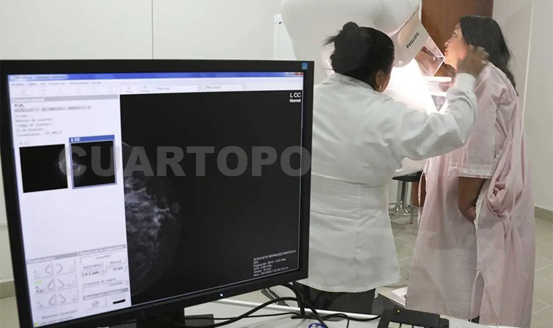 Recomiendan a mujeres realizarse mastografía