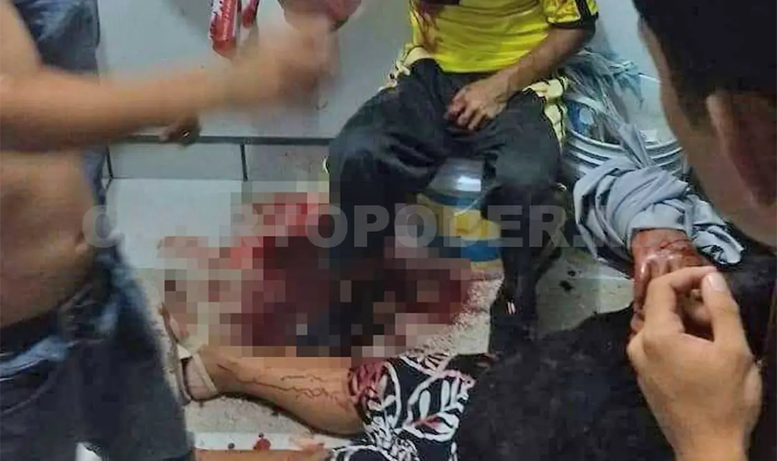 Familia es atacada por feroz pitbull