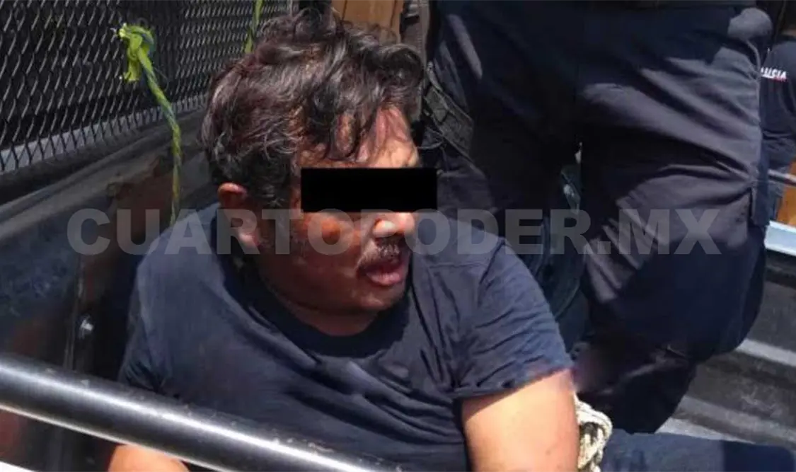 Le mutilan la mano por una presunta infidelidad