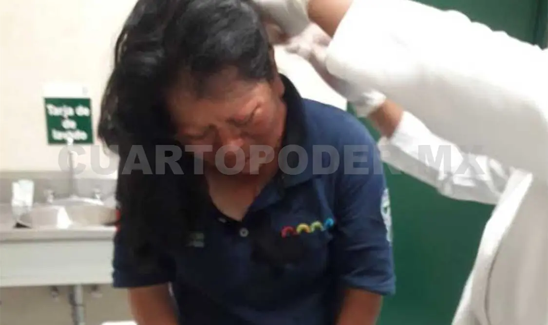 Mujer policía fue atacada a golpes por su pareja