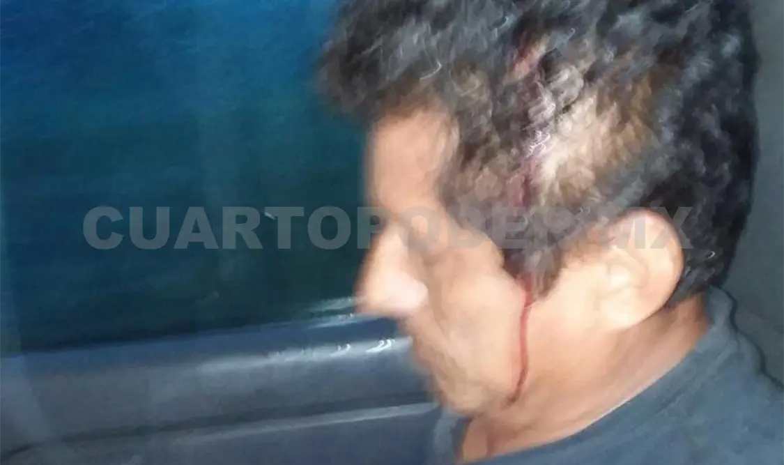 Las personas que viajaban en la unidad del transporte irregular resultaron con heridas en la cabeza. Dalia Villatoro / CP