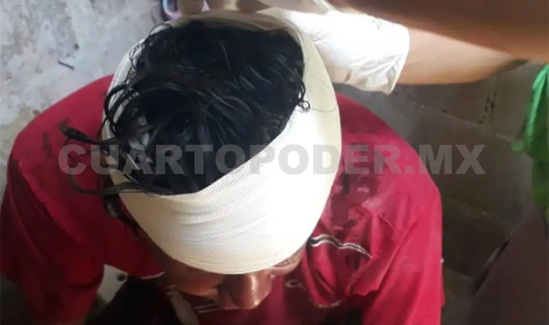Como pudo, la víctima regreso a su domicilio donde fueron familiares quienes dieron aviso a las autoridades de la brutal golpiza. Edberg Mayorga / CP