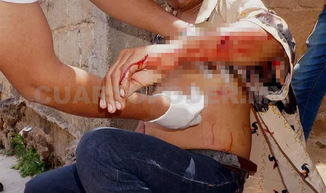 Lo machetean y le provocan dos heridas