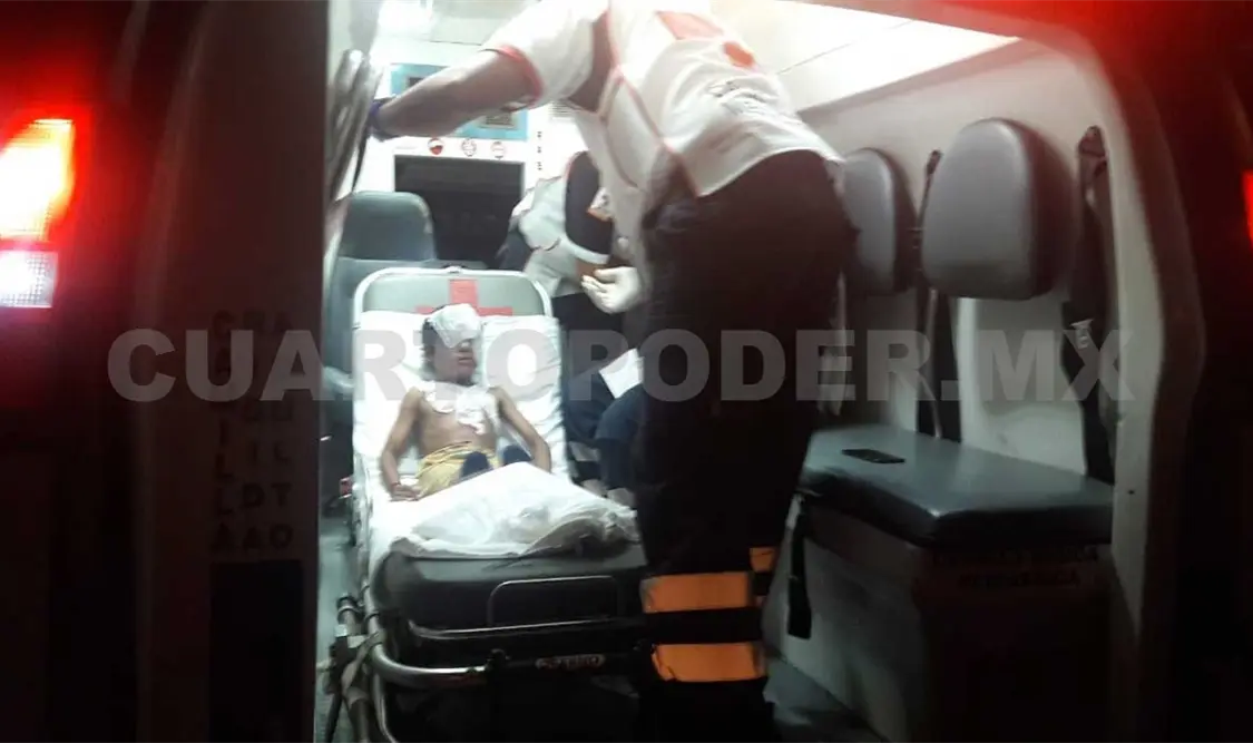 Niño se quema con la olla de la comida