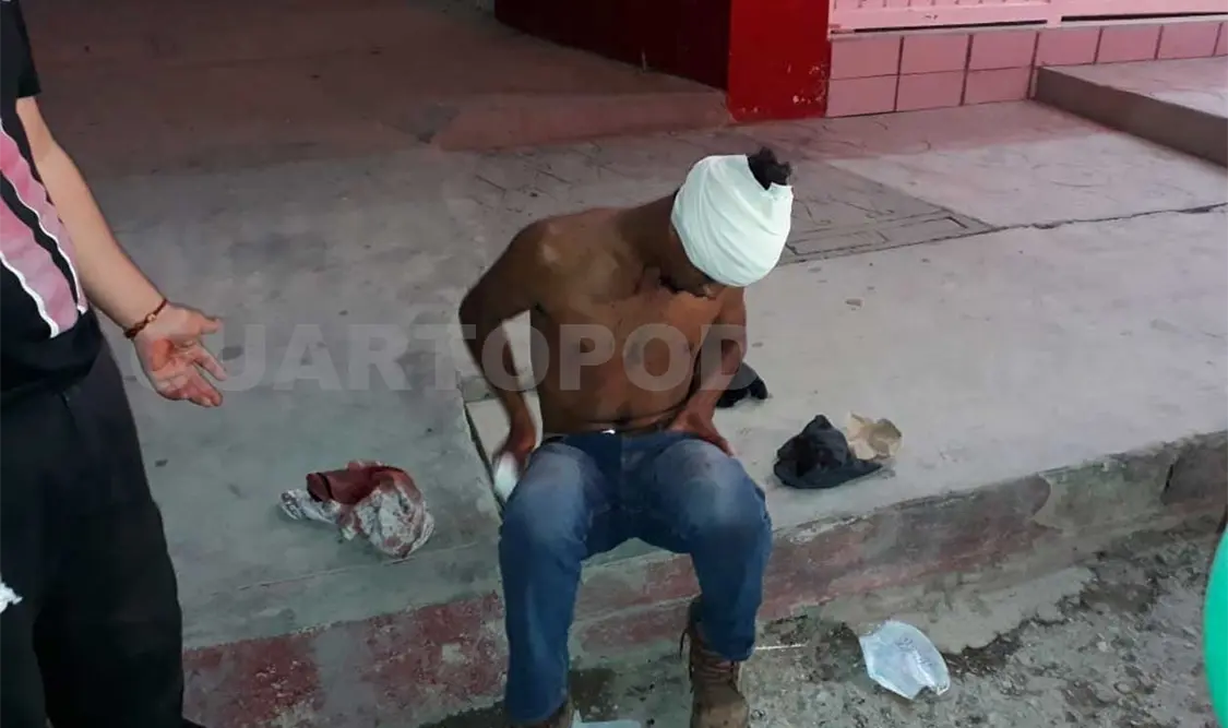 Hondureño es golpeado al resistirse a atraco