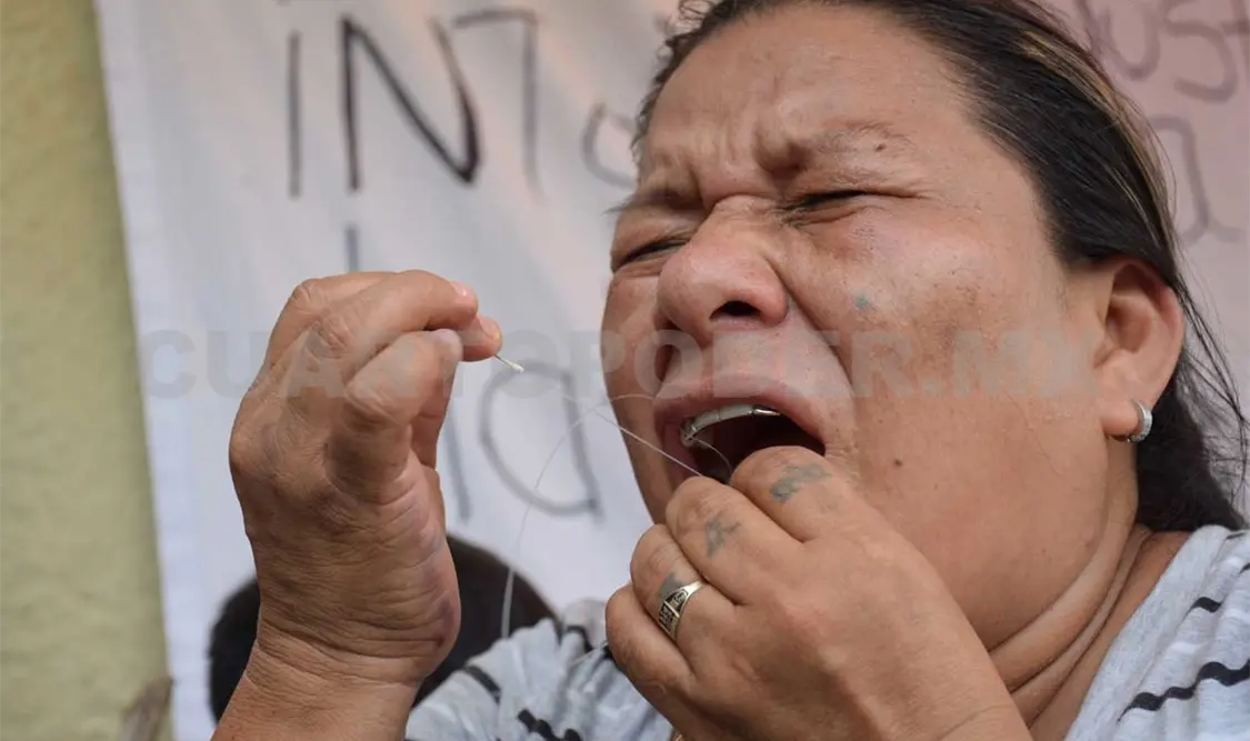 Se sutura los labios para exigir atención