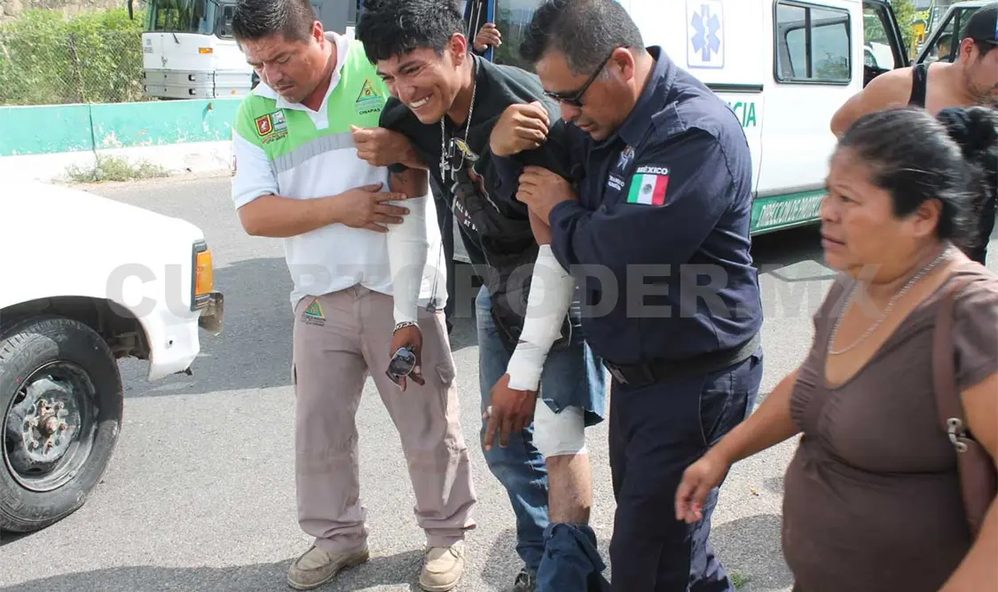 Motociclista queda con una fractura en la pierna