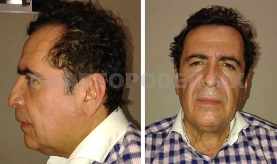 Murió de un infarto Héctor Beltrán Leyva “El H”