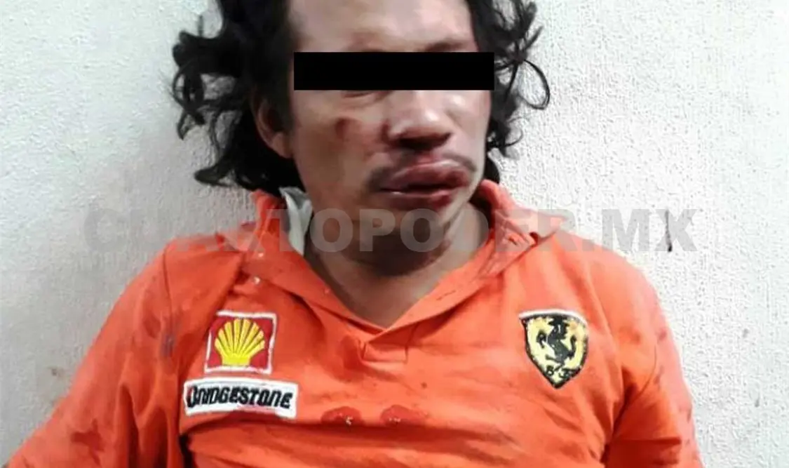 Hijo ebrio macheteó a sus padres; fue detenido