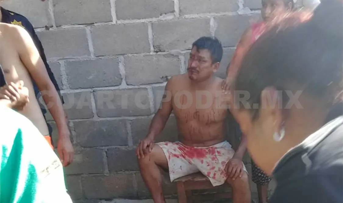 Batalla campal deja a varios lesionados