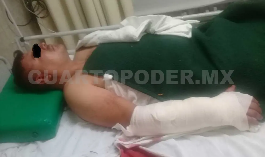 Policía y agente migratorio heridos a balazos en forcejeo