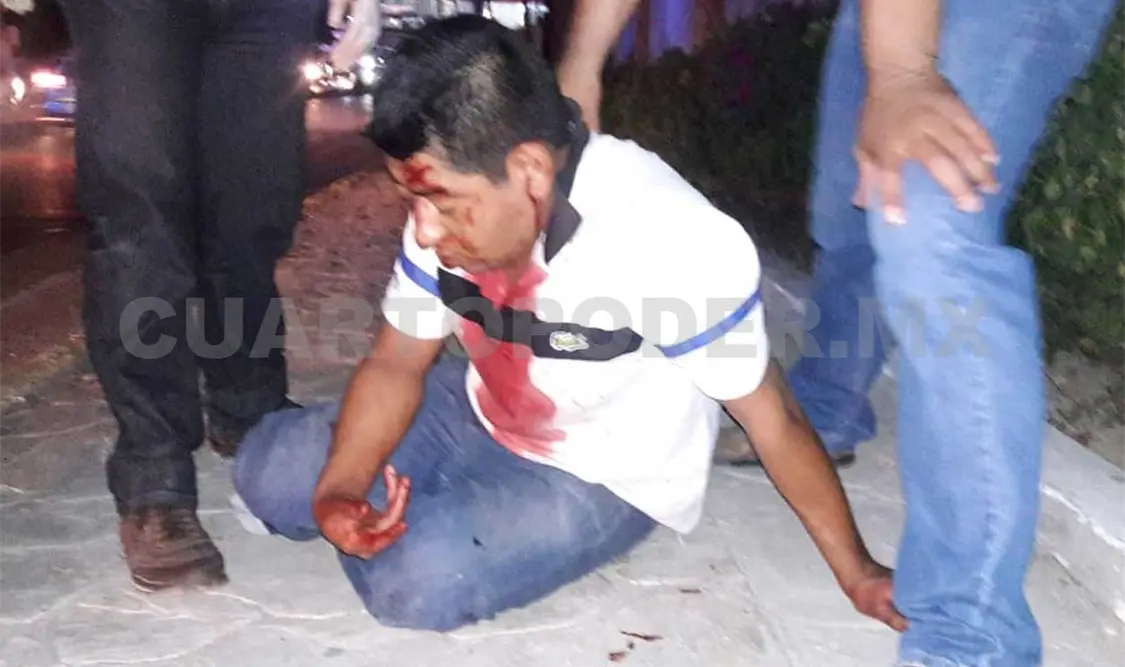 El motociclista resultó con heridas en la cabeza al salir expulsado el casco de protección.