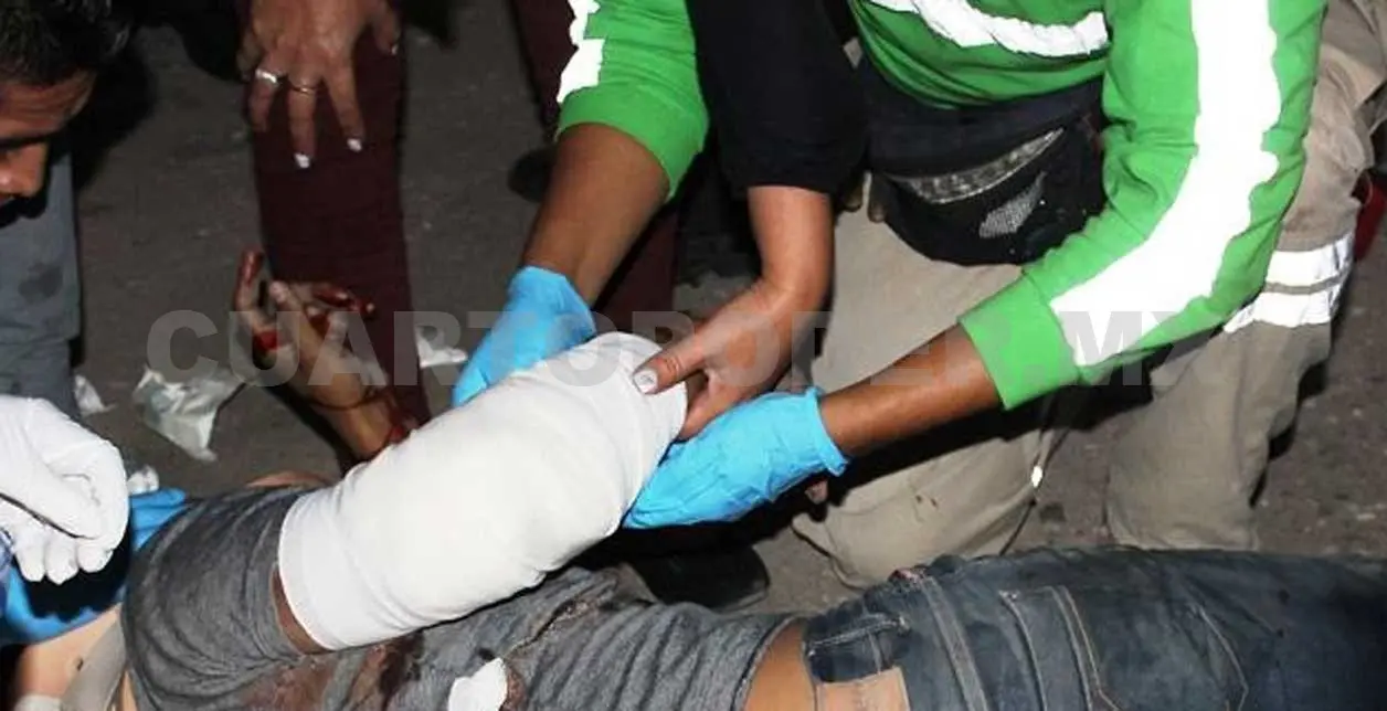 Joven casi pierde el brazo en percance