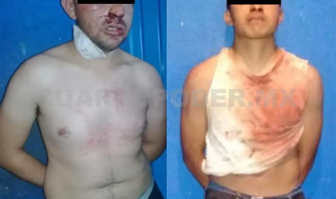 En violento asalto balean a dos elementos policiacos