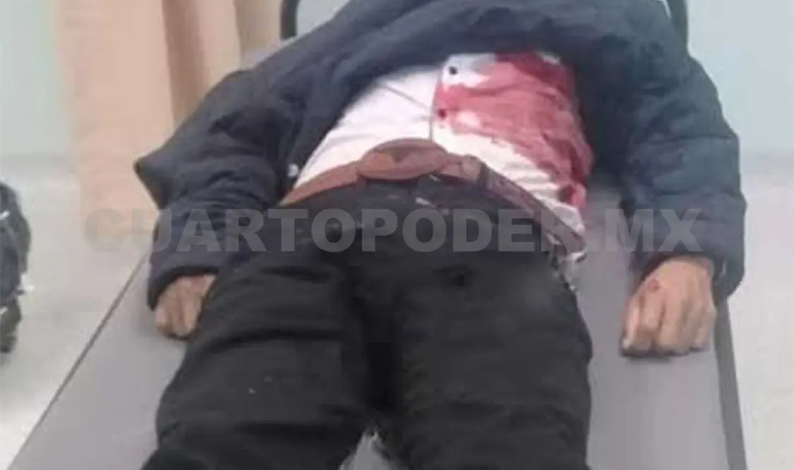 Enrique Méndez López lamentablemente perdió la vida debido a los impactos que presentaba en su anatomía. CP