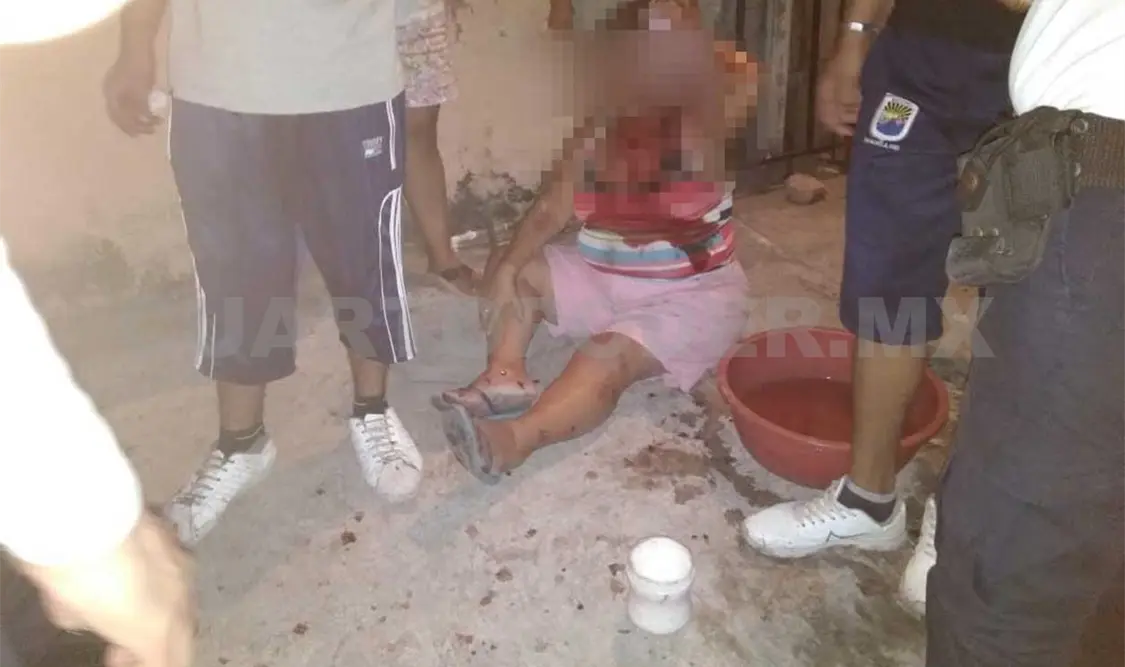 Madre e hijo heridos a machetazos