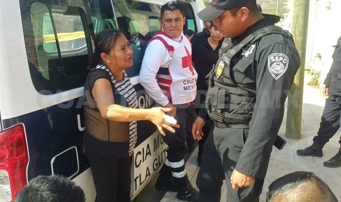 Dama fue macheteada por esposo tras discusión