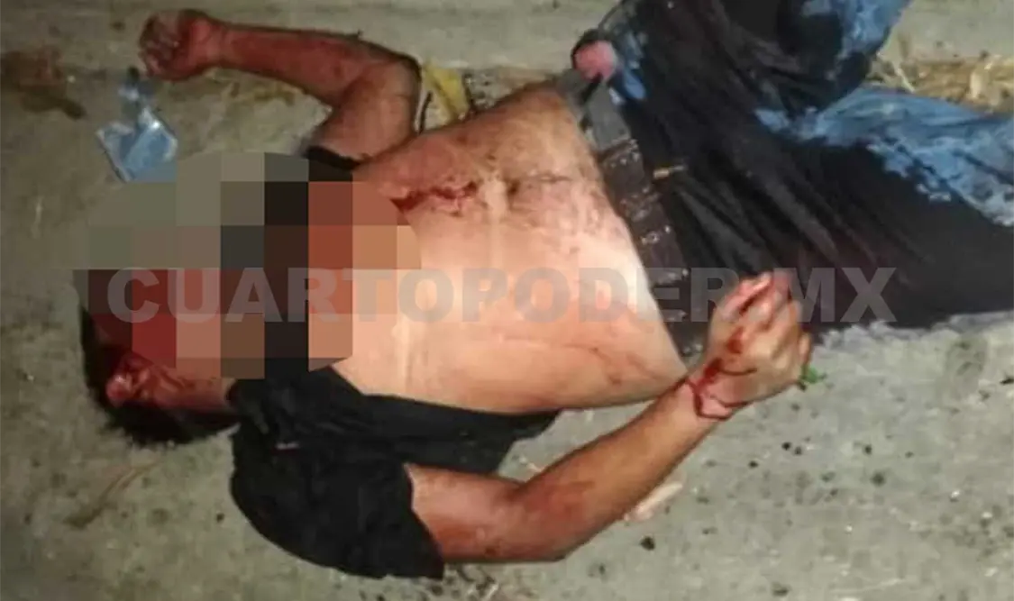 El cuerpo fue trasladado al Servicio Médico Forense para la práctica de la necropsia de ley. Rafael Victorio / CP