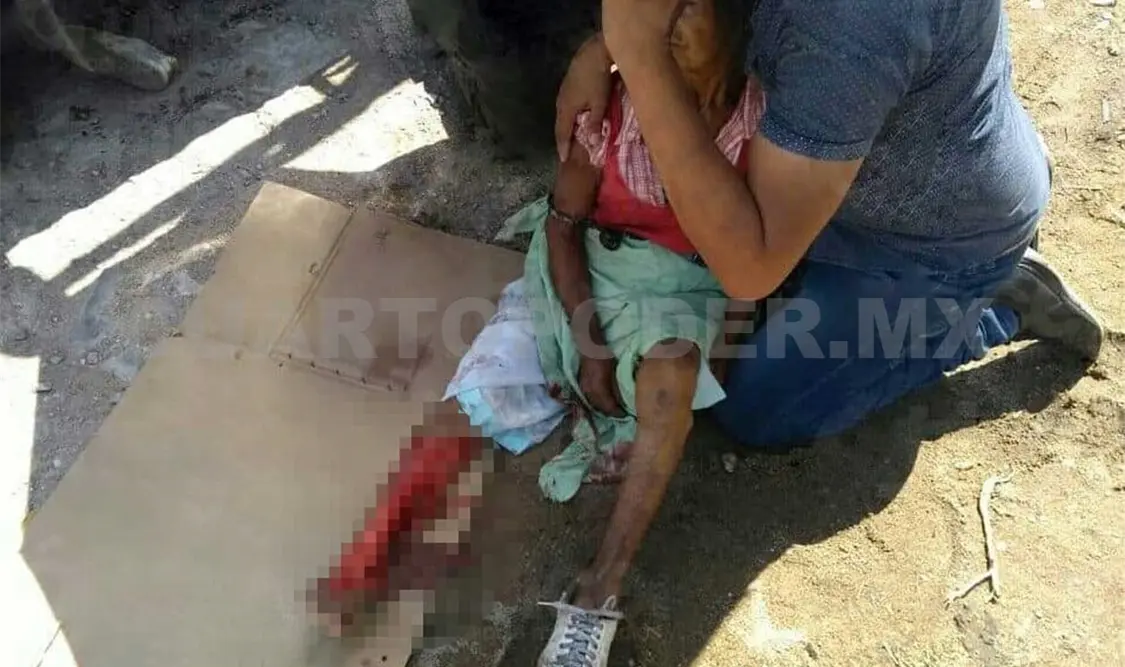Adulta mayor queda desollada de la pierna