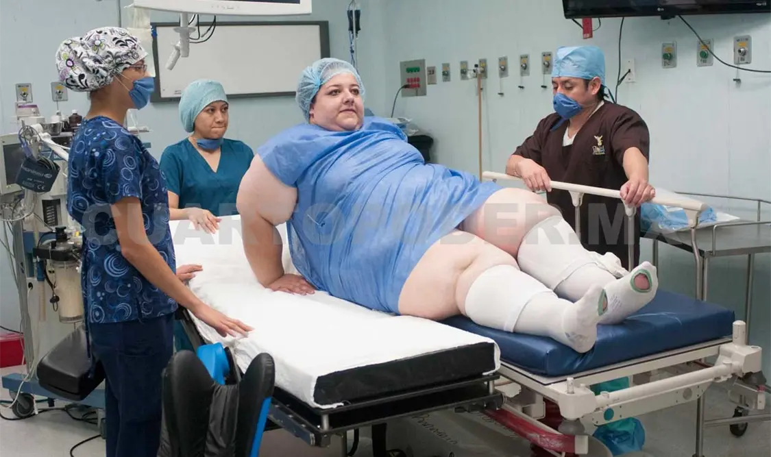 Obesidad, creciente desafío para la salud