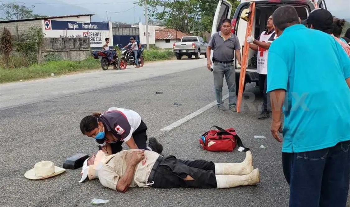 Grave abuelito tras ser arrollado en la Costera