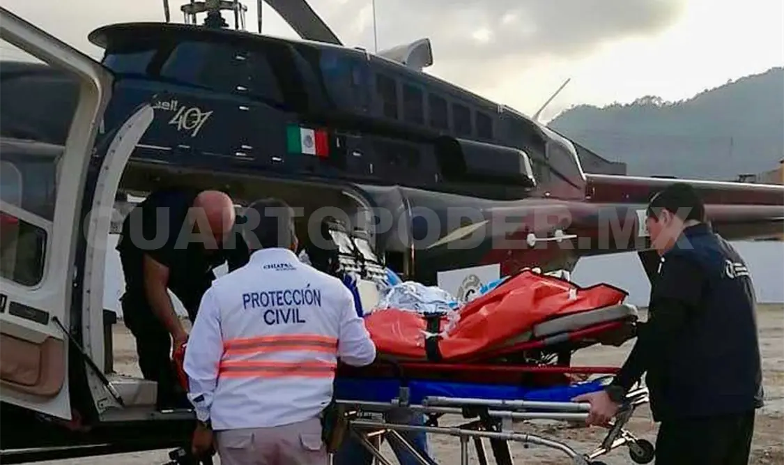 Trasladan a menor que sufrió quemaduras de alto grado