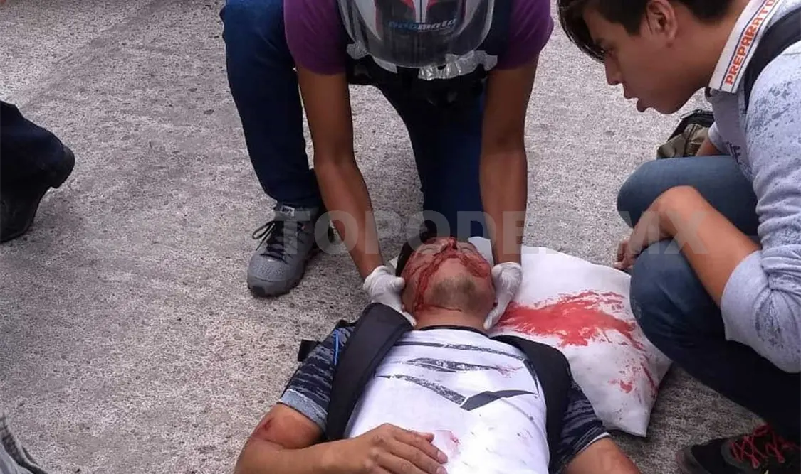 El joven de 20 años de edad, fue trasladado a un hospital para recibir atención especializada. Dalia Villatoro / CP