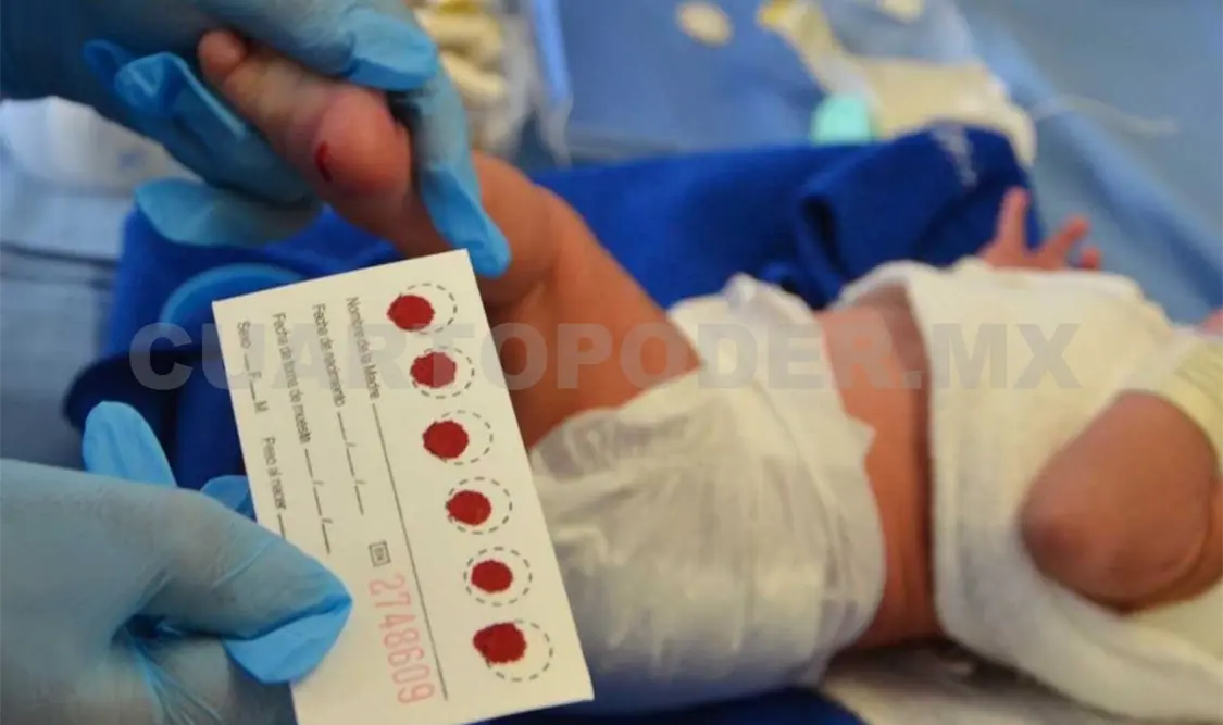 La aplicación del tamiz neonatal ha permitido la detección oportuna de padecimientos congénitos. Agencias