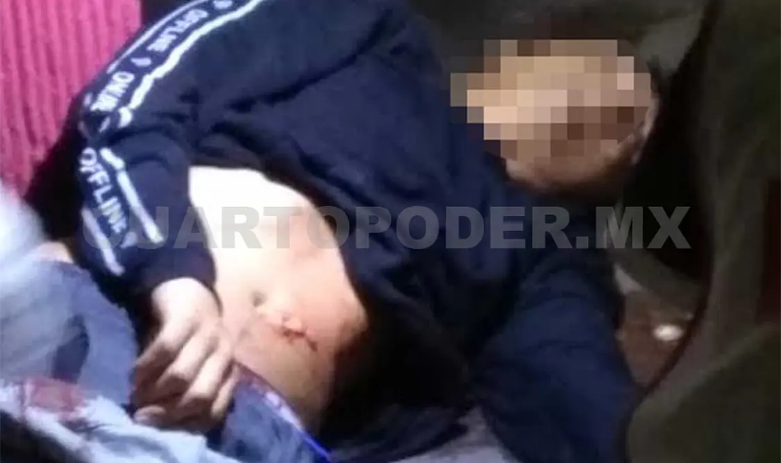 Paramédicos de la Cruz Roja Mexicana trasladaron a los heridos a un hospital de la ciudad. Rafael Victorio / CP
