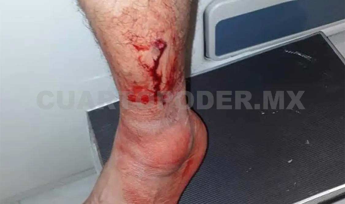 Miguel Ángel (33 años) resultó con un impacto con arma de fuego en la pierna al resistirse al asalto. Flor Cordero / CP