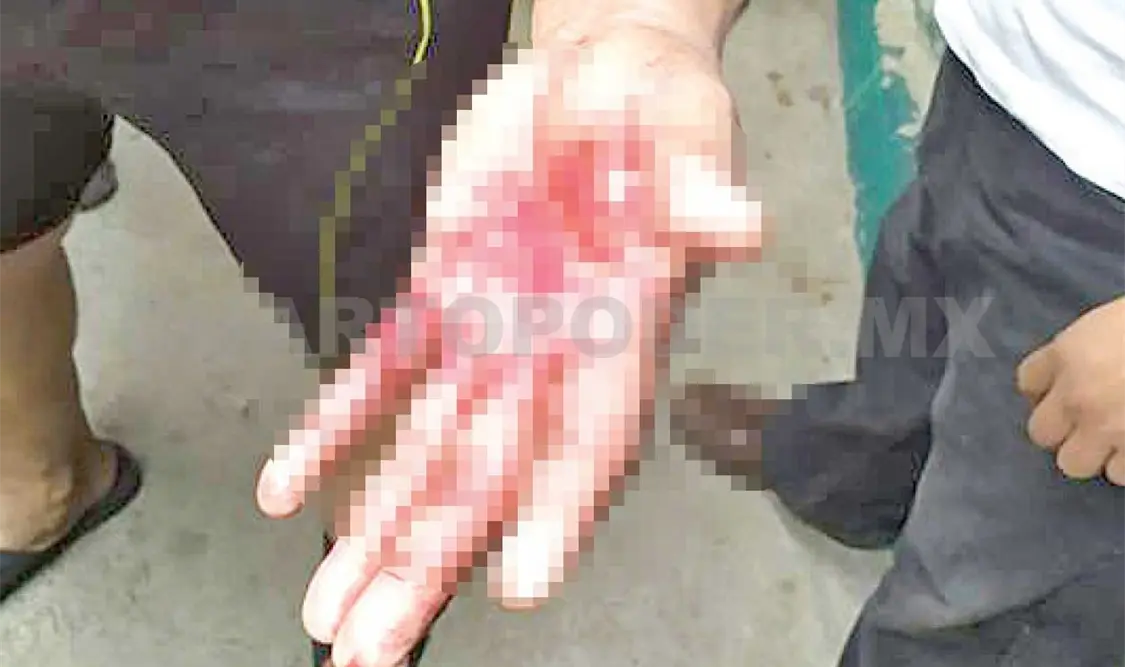 Su vecino lo macheteó en una vecindad en Tapachula