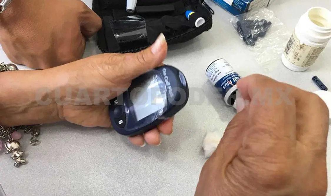 Después de la operación, los pacientes deben asistir a consulta médica cada tres o seis meses. Agencias