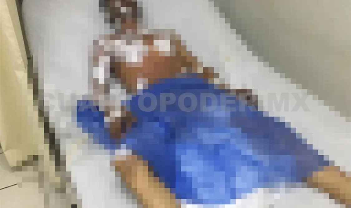 Prenden fuego a sujeto por deuda