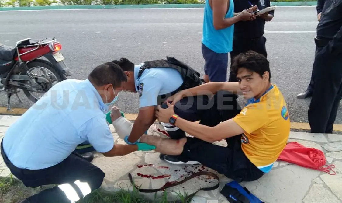 Joven derrapa y casi se cercena el pie