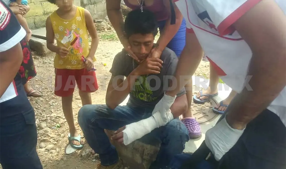 Casi le cercenan la mano de un machetazo