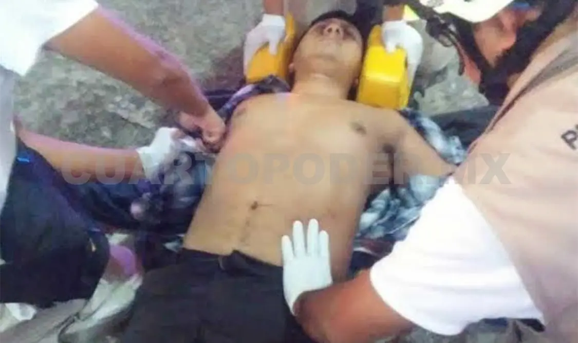 Personal del Sistema Municipal de Protección Civil trasladaron al herido a un hospital para recibir atención médica. Rafael Victorio / CP