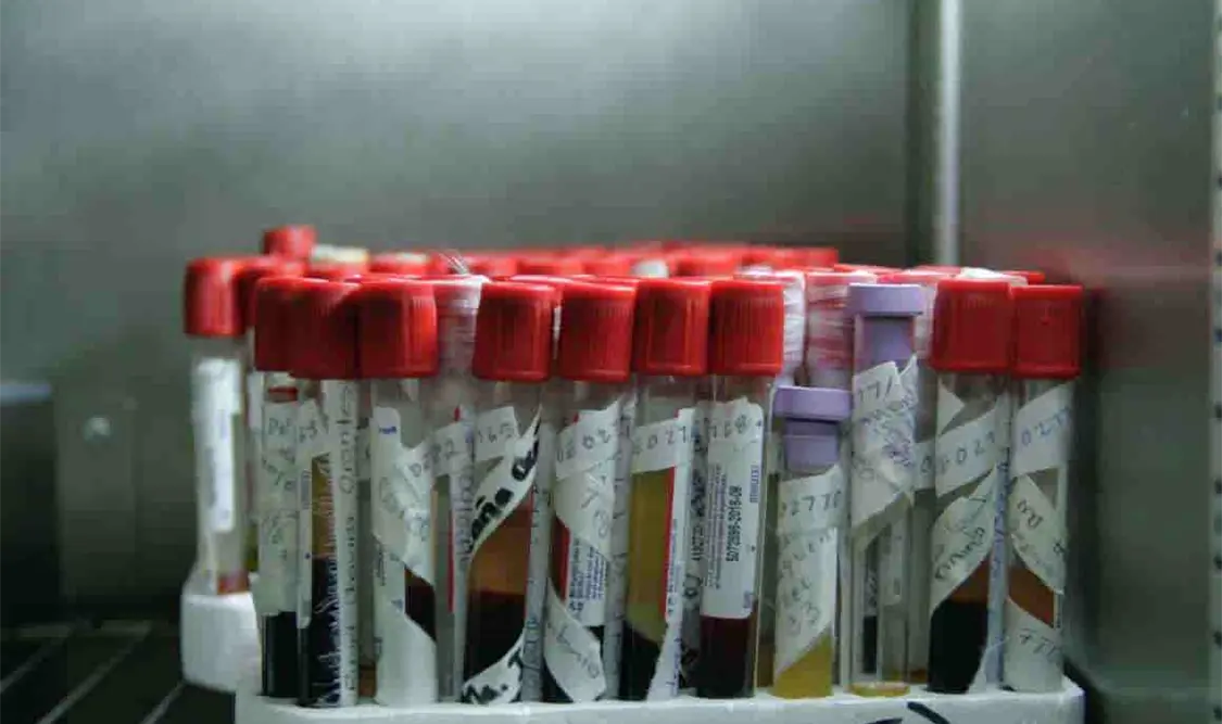 El índice de reportes en donadores de Hepatitis B y C es bajo, aseguró la especialista Mayorga Vidal. Guillermo Ramos / CP