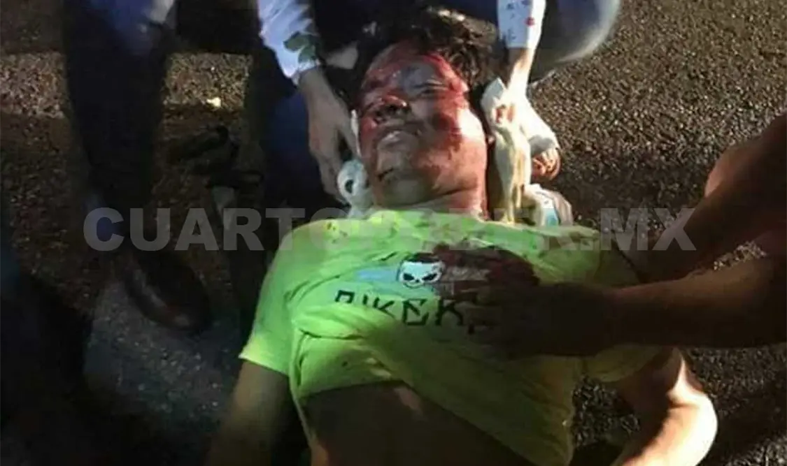 Tras sufrir el percance, la víctima fue auxiliada en primera instancia por los transeúntes, quienes dieron parte a las autoridades. Edberg Mayorga / CP