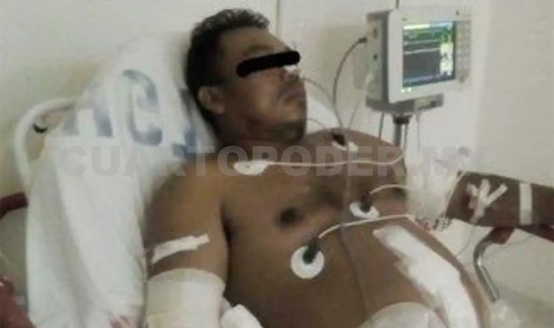 La víctima de nombre Natalio “N”, de 38 años de edad se debate entre la vida y la muerte en un hospital debido a los impactos de bala que recibió durante el ataque. CP