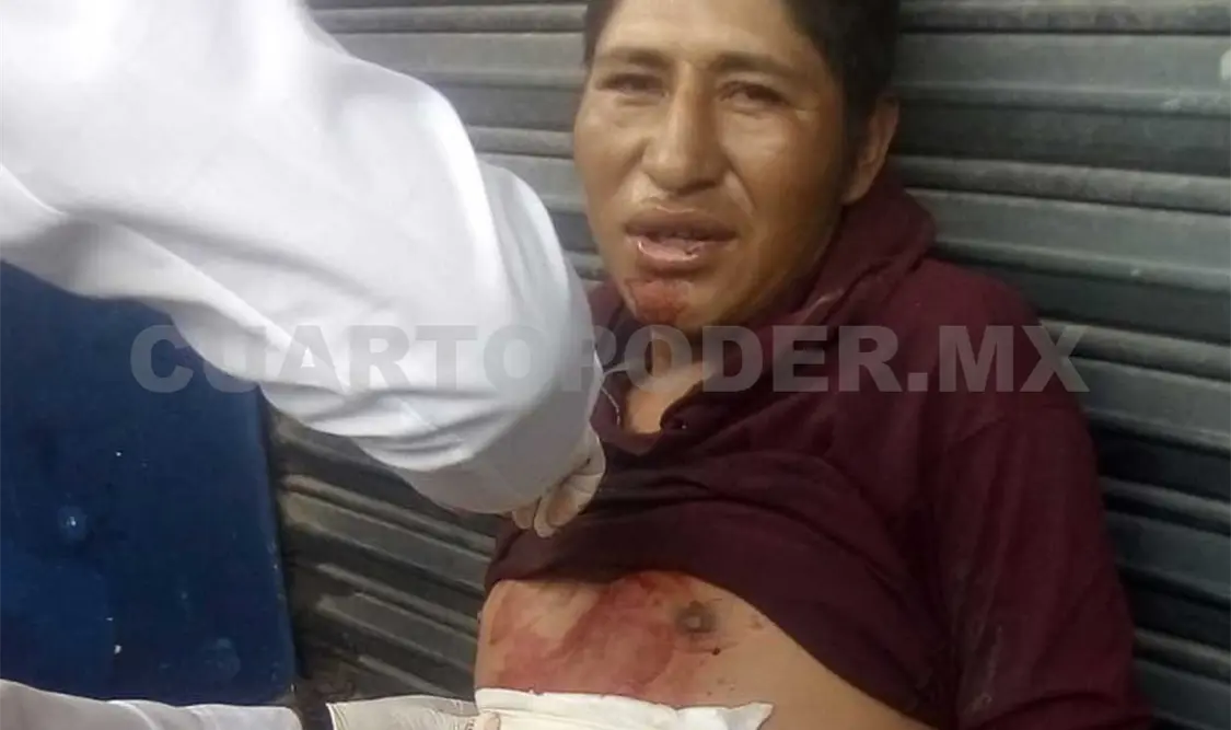 La víctima fue trasladada al Hospital Regional, pues presentaba abundante sangrado. Juan Orel / CP